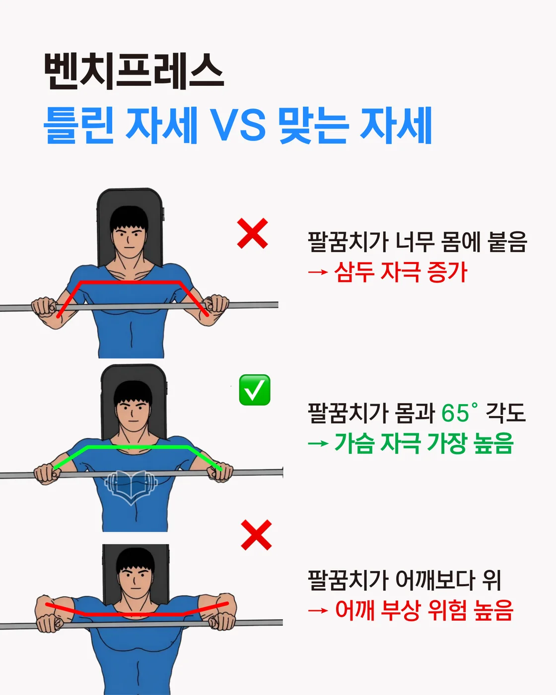 팔꿈치를 과하게 벌렸을 때 어깨 부담이 커지는 것을 설명하는 이미지