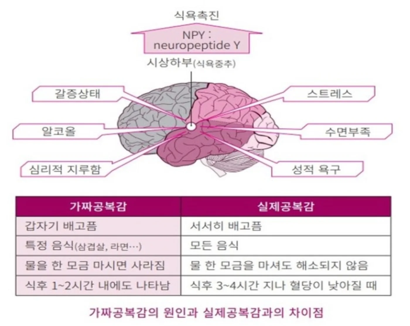 탈수 상태에서 배고픔으로 착각하는 흐름을 설명하는 이미지